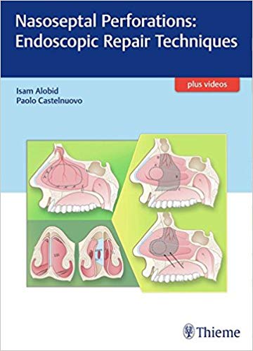 (eBook PDF)Nasoseptal Perforations Endoscopic Repair Techniques + Videos by Isam Alobid , Paolo Castelnuovo 