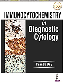 (eBook PDF)Immunocytochemistry in Diagnostic Cytology by Pranab Dey