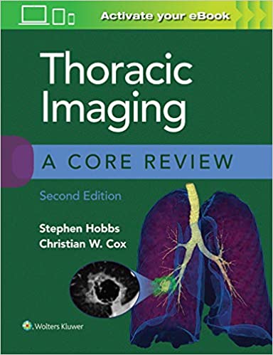 (eBook HTML)Thoracic Imaging A Core Review 2nd Edition by Stephen Hobbs MD , Christian Cox MD 