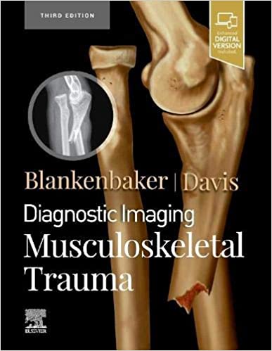 (eBook PDF)Diagnostic Imaging Musculoskeletal Trauma, 3rd Edition E-Book by Donna G Blankenbaker MD FACR , Kirkland W. Davis MD FACR 