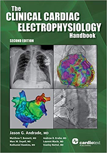 (eBook PDF)Clinical Cardiac Electrophysiology Handbook, 2nd Edition by Jason G. Andrade MD , Matthew T. Bennett MD , Marc W. Deyell MD 