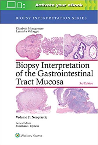 (eBook PDF)Biopsy Interpretation of the Gastrointestinal Tract Mucosa: Volume 2: Neoplastic Third Edition by Elizabeth A. Montgomery MD , Lysandra Voltaggio MD 