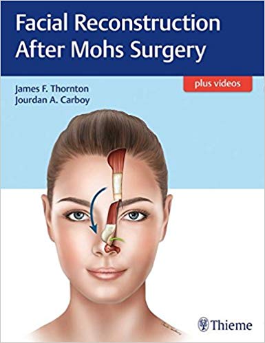 (eBook PDF)Facial Reconstruction After Mohs Surgery by James Thornton , JOURDAN CARBOY 