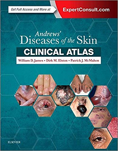 (eBook PDF)Andrews  Diseases of the Skin Clinical Atlas by William D. James MD , Dirk Elston MD , Patrick J. McMahon MD 