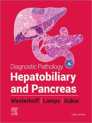 (eBook PDF)Diagnostic Pathology Hepatobiliary and Pancreas E-Book 3rd Edition by Laura Webb Lamps , Maria Westerhoff , Sanjay Kakar 