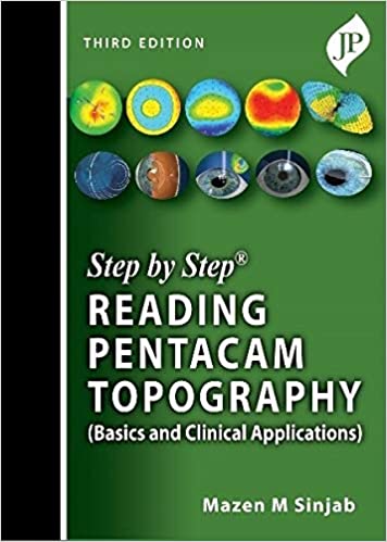 (eBook PDF)Step By Step Reading Pentacam Topography 3rd Edition by Mazen M Sinjab