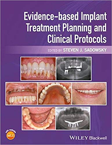 (eBook PDF)Evidence-based Implant Treatment Planning and Clinical Protocols by Steven J. Sadowsky 