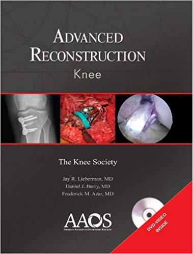 (eBook PDF)Adcanced Reconstruction - Knee by Jay R. Lieberman , Daniel J. Berry , Frederick M. Azar 