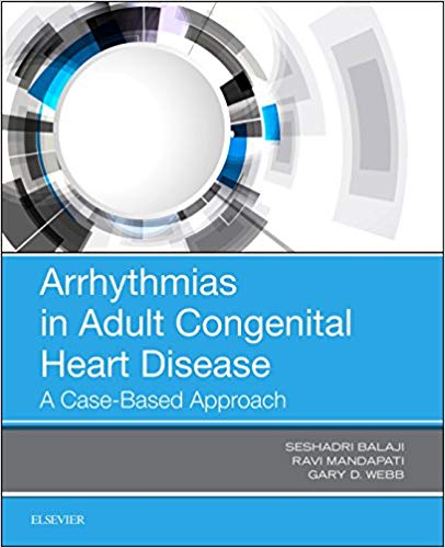 (eBook PDF)Arrhythmias in Adult Congenital Heart Disease: A Case-Based Approach 1st Edition by Balaji Seshadri MBBS MRCP(UK) PhD , Ravi Mandapati MD , Gary Webb MD 