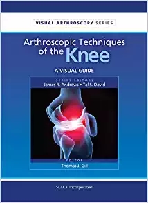 (eBook PDF)Arthroscopic Techniques of the knee by Thomas Gill MD 