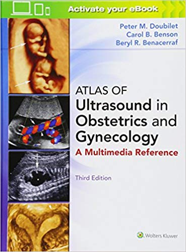 (eBook PDF)Atlas of Ultrasound in Obstetrics and Gynecology 3rd Edition (300 VIDEO Inlcuded) by Peter M. Doubilet MD PhD , Carol B. Benson MD , Beryl R. Benacerraf MD 