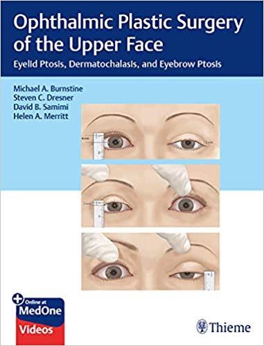 (eBook PDF)Ophthalmic Plastic Surgery of the Upper Face PDF+VIDEOS by Michael A. Burnstine , Steven C. Dresner , David B. Samimi 