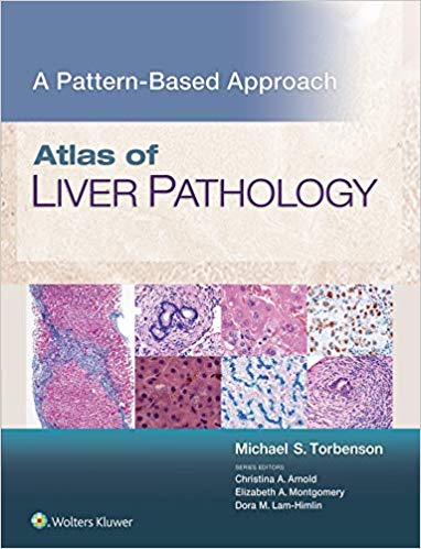 (eBook PDF)Atlas of Liver Pathology: A Pattern-Based Approach by Michael Torbenson 