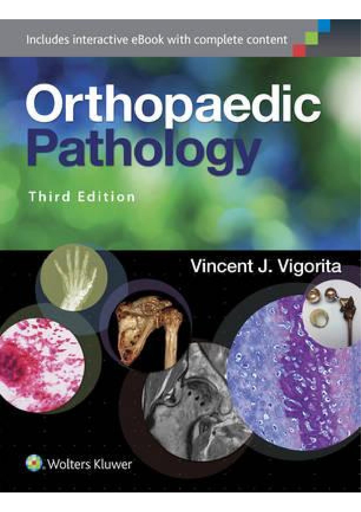 (eBook PDF)Orthopaedic Pathology 3rd Third Edition by Vincent J. Vigorita MD 