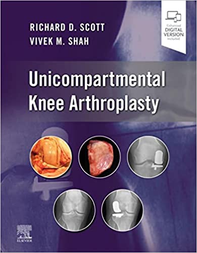 (eBook PDF)Unicompartmental Knee Arthroplasty, E-Book by Richard D. Scott , Vivek Shah 