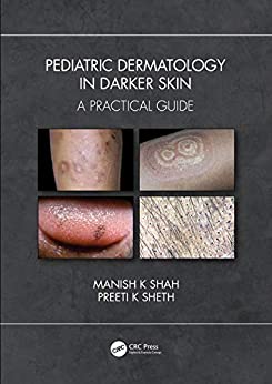 (eBook PDF)Pediatric Dermatology in Skin of Color