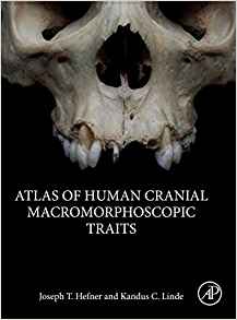 (eBook PDF)Atlas of Human Cranial Macromorphoscopic Traits by Joseph T. Hefner , Kandus C. Linde 