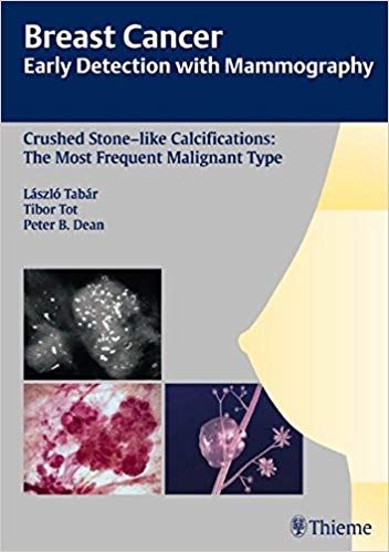 (eBook PDF)Breast Cancer - Early Detection with Mammography e, 1e  by Laszlo Tabar (Author, Series Editor), Tibor Tot , Peter B. Dean 