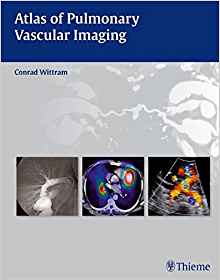 (eBook PDF)Atlas of Pulmonary Vascular Imaging by Conrad Wittram 