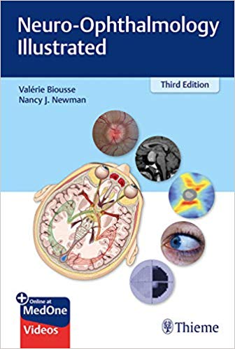 (eBook PDF)Neuro-Ophthalmology Illustrated 3rd Edition PDF+69 VIDEOS by Valerie Biousse , Nancy Newman 