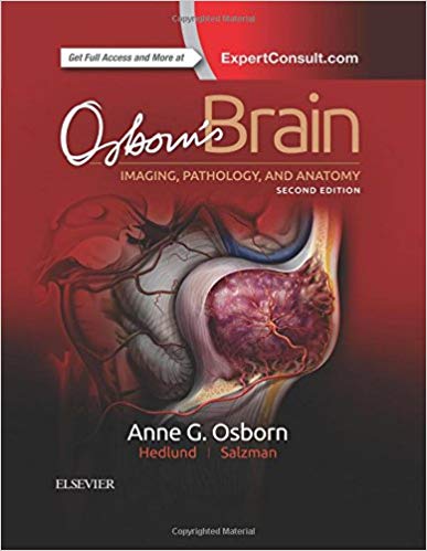 (eBook PDF)Osborn s Brain 2nd Edition by Anne G. Osborn MD FACR , Gary L. Hedlund DO , Karen L. Salzman MD 