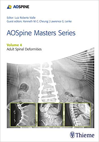 (eBook PDF)AOSpine Masters Series, Volume 4 Adult Spinal Deformities by Lawrence G Lenke , Kenneth Cheung 