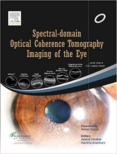 (eBook PDF)Spectral-domain Optical Coherence Tomography Imaging of the Eye by Anand Vinekar 