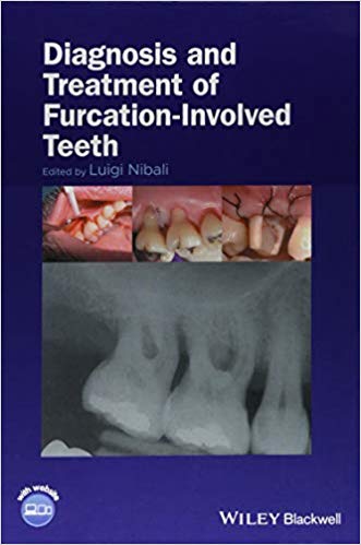 (eBook PDF)Diagnosis and Treatment of Furcation-Involved Teeth by Luigi Nibali 