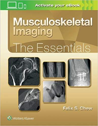 (eBook PDF)Musculoskeletal Imaging - The Essentials  by Felix S. Chew MD 