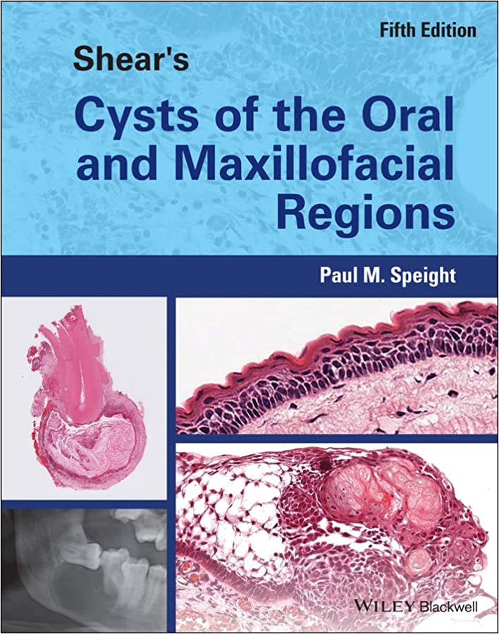 (eBook PDF)Shear s Cysts of the Oral and Maxillofacial Regions 5th Edition by Paul M. Speight 