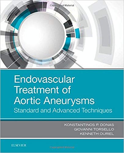 (eBook PDF)Endovascular Treatment of Aortic Aneurysms: Standard and Advanced Techniques, 1e 1st Edition by Konstantinos P. Donas MD PhD , Giovanni Torsello MD , Ken Ouriel MD 