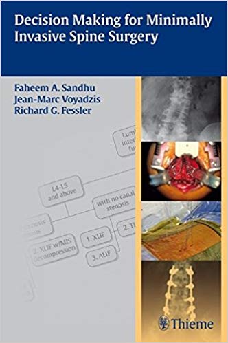 (eBook PDF)Decision Making for Minimally Invasive Spine Surgery by Faheem A. Sandhu , Jean-Marc Voyadzis , Richard Glenn Fessler 