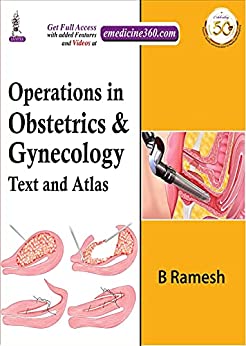 (eBook PDF)Operations in Obstetrics & Gynecology Text And Atlas by B Ramesh