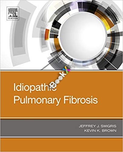 (eBook PDF)Idiopathic Pulmonary Fibrosis  by Jeffrey Swigris , Kevin K Brown 