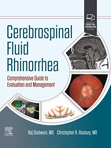 (eBook PDF)Cerebrospinal Fluid Rhinorrhea by Raj Sindwani , Christopher Roxbury 