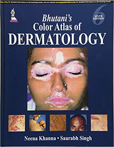 (eBook PDF)Bhutani'S Color Atlas Of Dermatology 6th Edition by Khanna Neena 