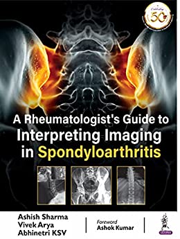 (eBook PDF)A Rheumatologist S Guide To Interpreting Imaging In Spondyloarthritis by Ashish Sharma , Vivek Arya , Abhinetri KSV 