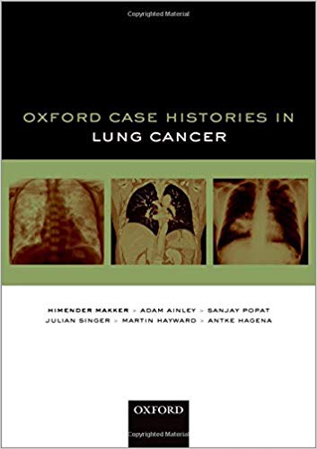 (eBook PDF)Oxford Case Histories in Lung Cancer by Himender K. Makker , Adam Ainley , Sanjay Popat , Julian Singer , Martin Hayward , Antke Hagena 