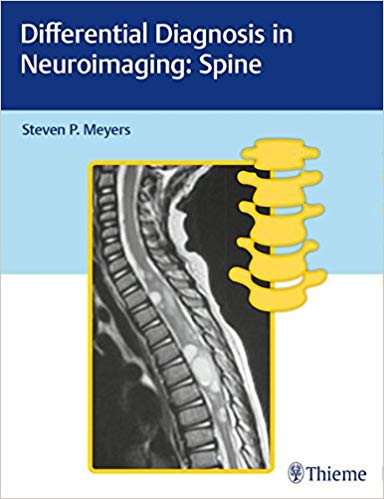 (eBook PDF)Differential Diagnosis in Neuroimaging: Spine by Steven Meyers 