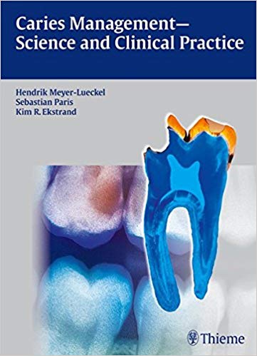 (eBook PDF)Caries Management - Science and Clinical Practice by Hendrik Meyer-Lueckel , Hendrik Meyer-Lückel , Sebastian Paris , Kim Ekstrand 