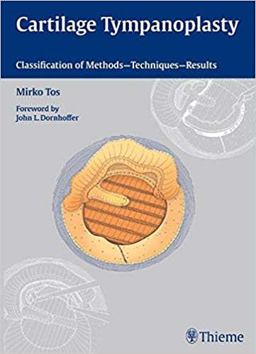 (eBook PDF)Cartilage Tympanoplasty - Classification of Methods Techniques Results by Mirko Tos 