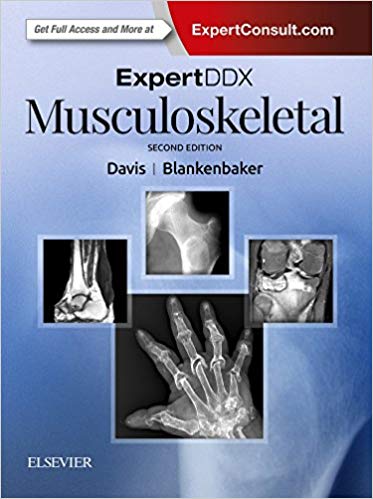 (eBook PDF)ExpertDDx Musculoskeletal, 2nd Edition by Kirkland W. Davis MD FACR , Donna G Blankenbaker MD 