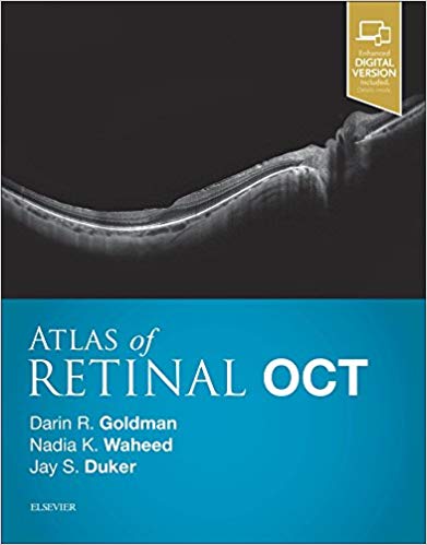 (eBook PDF)Atlas of Retinal OCT: Optical Coherence Tomography, 1e Har/Psc Edition by Darin Goldman MD , Nadia K Waheed MD MPH , Jay S. Duker MD 