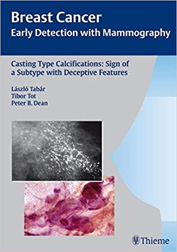 (eBook PDF)Casting Type Calcifications (Rare) by Laszlo Tabar , Tibor Tot , Peter B. Dean 