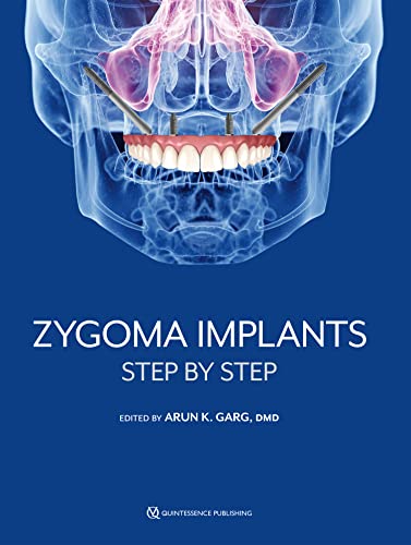 (eBook PDF)Zygoma Implants Step by Arun K. Garg 