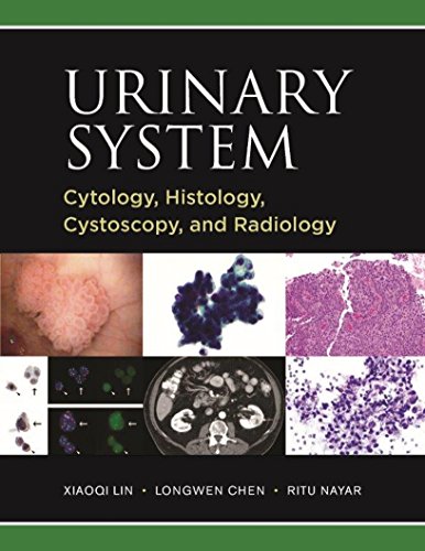 (eBook PDF)Urinary System Cytology, Histology, Cystoscopy, and Radiology by Xiaoqi Lin;Longwen Chen;Ritu Nayar , Linda H. Mehta 