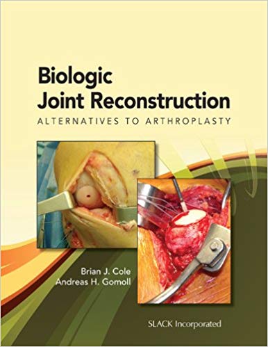 (eBook PDF)Biologic Joint Reconstruction by Dr. Brian Cole MD , Andreas Gomoll MD 