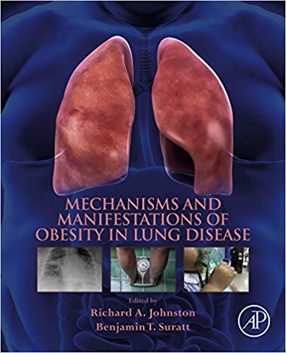 (eBook PDF)Mechanisms and Manifestations of Obesity in Lung Disease by Richard A. Johnston , Benjamin T. Suratt 