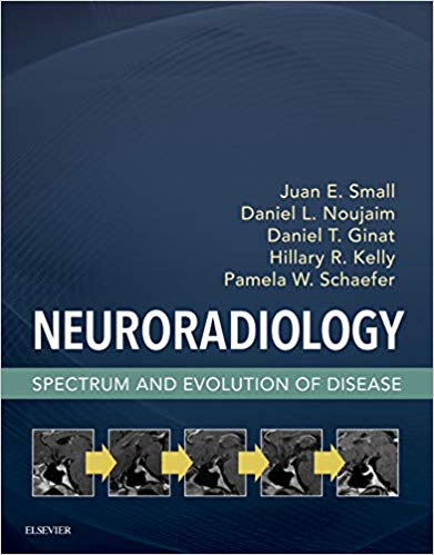 (eBook PDF)Neuroradiology: Spectrum and Evolution of Disease by Juan E. Small , Daniel L. Noujaim , Daniel T. Ginat , Hillary R. Kelly , Pamela W. Schaefer 