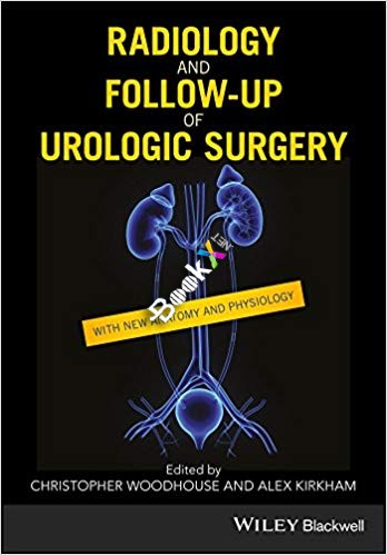 (eBook PDF) Radiology and Follow-up of Urologic Surgery by Christopher R. J. Woodhouse , Alex Kirkham 